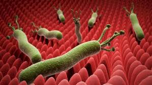 خطورة الدودة الحلزونية اكله اللحوم الحيه بعد اعلان أمريكا ظهور اول حاله مرضيه